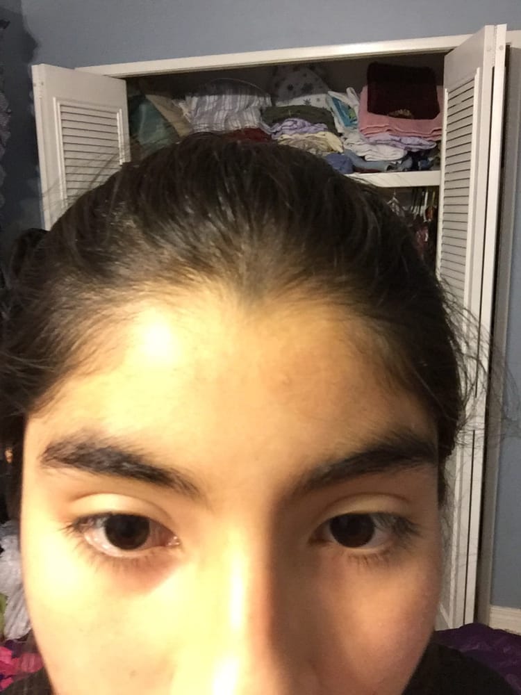 Edmonton Laser Centre