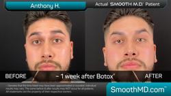 Smooth M.D. Skin + Laser Bar