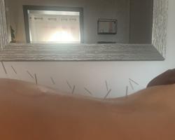 Dynamic Healing Acupuncture