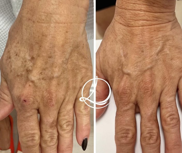 Photo credit: 