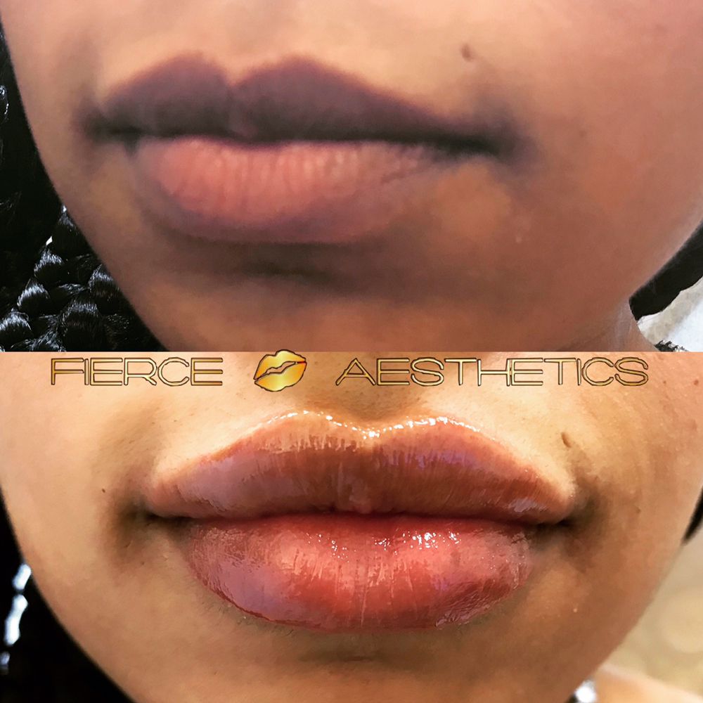 Photo credit: 